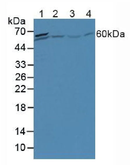 Western blot - Anti-A1CF/ACF antibody (AB231614)