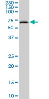 Western blot - Anti-A1CF/ACF antibody (AB89050), expandable thumbnail