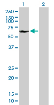 Western blot - Anti-A1CF/ACF antibody (AB89050), expandable thumbnail