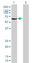 Western blot - Anti-A1CF/ACF antibody (AB89050)