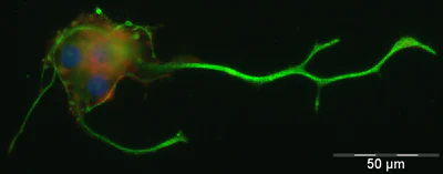 Immunocytochemistry/ Immunofluorescence - Anti-A2B5 antibody [105] (AB53521)