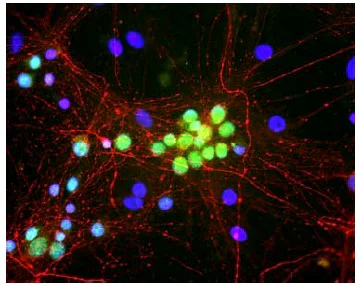 Immunocytochemistry/ Immunofluorescence - Anti-A2BP1/Fox1/RBFOX1 antibody [1G10] (AB183348)