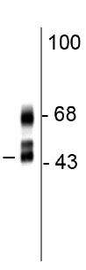 Western blot - Anti-A2BP1/Fox1/RBFOX1 antibody [1G10] (AB183348)