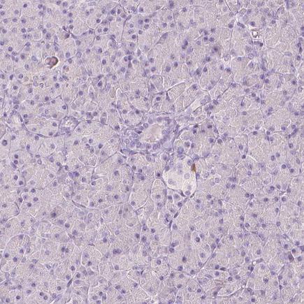 Immunohistochemistry (Formalin/PFA-fixed paraffin-embedded sections) - Anti-A2BP1/Fox1/RBFOX1 antibody (AB243727), expandable thumbnail
