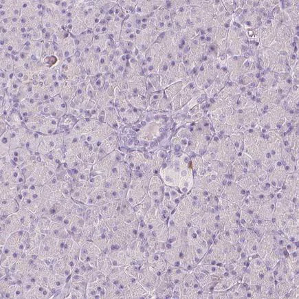 Immunohistochemistry (Formalin/PFA-fixed paraffin-embedded sections) - Anti-A2BP1/Fox1/RBFOX1 antibody (AB243727)