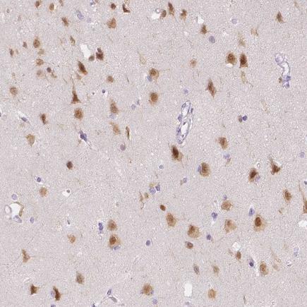 Immunohistochemistry (Formalin/PFA-fixed paraffin-embedded sections) - Anti-A2BP1/Fox1/RBFOX1 antibody (AB243727), expandable thumbnail