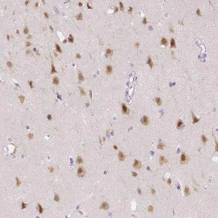 Immunohistochemistry (Formalin/PFA-fixed paraffin-embedded sections) - Anti-A2BP1/Fox1/RBFOX1 antibody (AB243727)