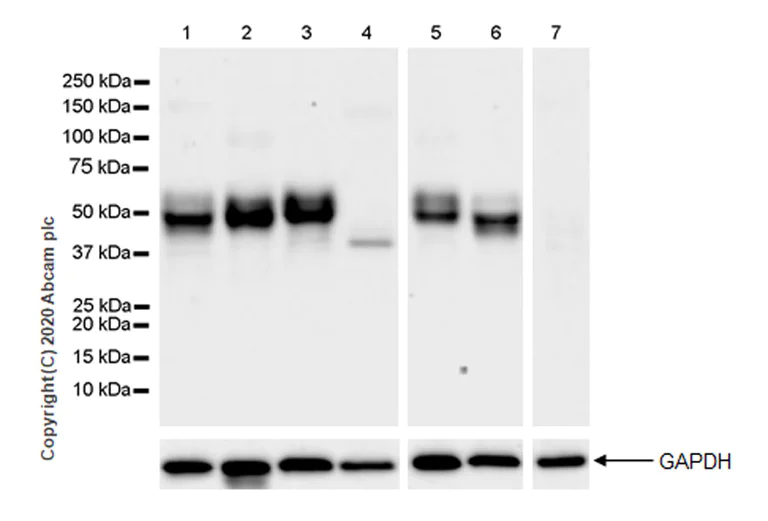 Western blot - Anti-A2BP1/Fox1/RBFOX1 antibody [EPR23656-5] - BSA and Azide free (AB278527)