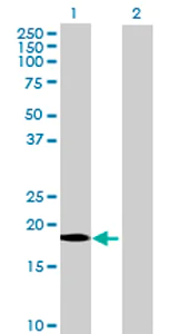 Western blot - Anti-A3H antibody (AB73055)