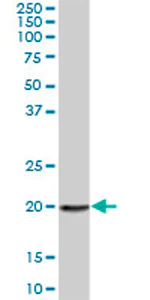 Western blot - Anti-A3H antibody (AB73055)