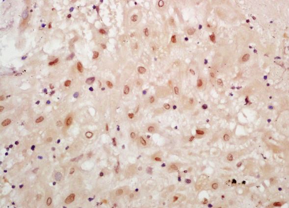 Immunohistochemistry (Formalin/PFA-fixed paraffin-embedded sections) - Anti-A4GALT antibody (AB203681)
