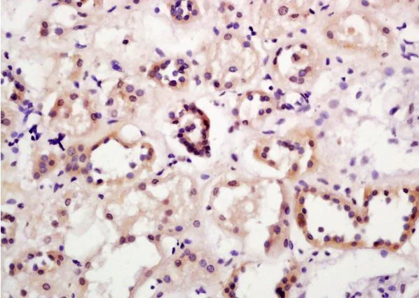 Immunohistochemistry (Formalin/PFA-fixed paraffin-embedded sections) - Anti-A4GALT antibody (AB203681)