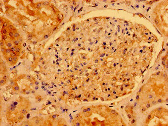 Immunohistochemistry (Formalin/PFA-fixed paraffin-embedded sections) - Anti-AACS antibody (AB237802)
