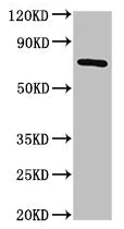 Western blot - Anti-AACS antibody (AB237802)