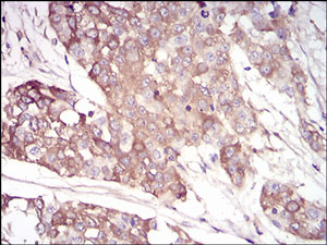 Immunohistochemistry (Formalin/PFA-fixed paraffin-embedded sections) - Anti-AACT antibody [5G3C11] - C-terminal (AB201987), expandable thumbnail