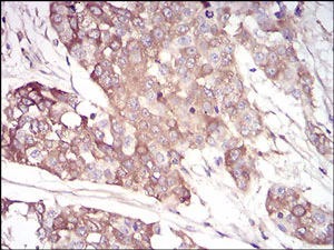 Immunohistochemistry (Formalin/PFA-fixed paraffin-embedded sections) - Anti-AACT antibody [5G3C11] - C-terminal (AB201987)