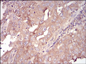 Immunohistochemistry (Formalin/PFA-fixed paraffin-embedded sections) - Anti-AACT antibody [5G3C11] - C-terminal (AB201987), expandable thumbnail