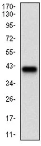 Western blot - Anti-AACT antibody [5G3C11] - C-terminal (AB201987)