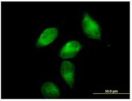 Immunocytochemistry/ Immunofluorescence - Anti-AACT antibody (AB88527)