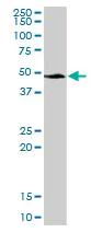 Western blot - Anti-AACT antibody (AB88527)
