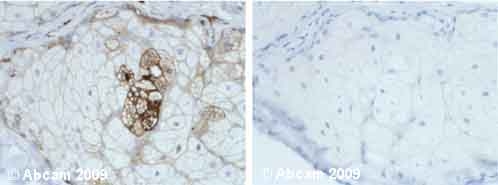 Immunohistochemistry (Formalin/PFA-fixed paraffin-embedded sections) - Anti-AACT antibody (AB9374)