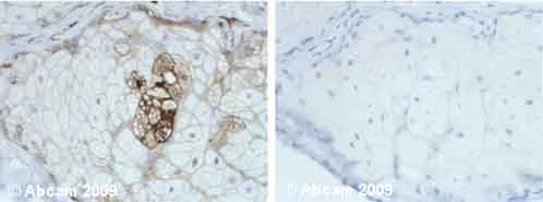Immunohistochemistry (Formalin/PFA-fixed paraffin-embedded sections) - Anti-AACT antibody (AB9374)