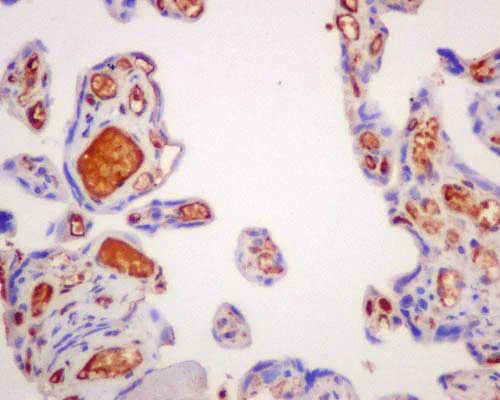 Immunohistochemistry (Formalin/PFA-fixed paraffin-embedded sections) - Anti-AACT antibody [EPR14117(B)] (AB180492)