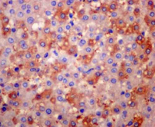 Immunohistochemistry (Formalin/PFA-fixed paraffin-embedded sections) - Anti-AACT antibody [EPR14117(B)] (AB180492)