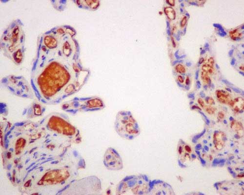 Immunohistochemistry (Formalin/PFA-fixed paraffin-embedded sections) - Anti-AACT antibody [EPR14117(B)] - BSA and Azide free (AB250195), expandable thumbnail