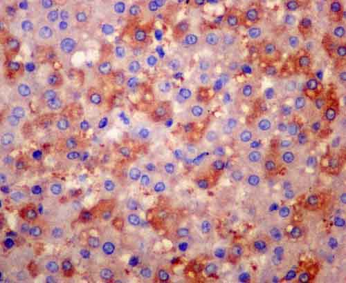 Immunohistochemistry (Formalin/PFA-fixed paraffin-embedded sections) - Anti-AACT antibody [EPR14117(B)] - BSA and Azide free (AB250195), expandable thumbnail