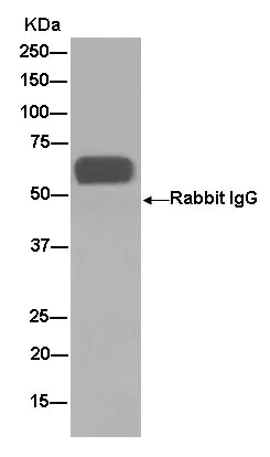 Immunoprecipitation - Anti-AACT antibody [EPR14117(B)] - BSA and Azide free (AB250195)