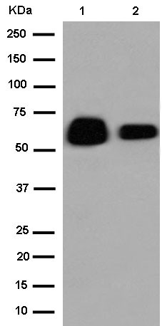 Western blot - Anti-AACT antibody [EPR14118(B)] (AB184567)