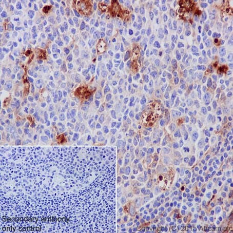 Immunohistochemistry (Formalin/PFA-fixed paraffin-embedded sections) - Anti-AACT antibody [EPR17088-68] (AB205198), expandable thumbnail