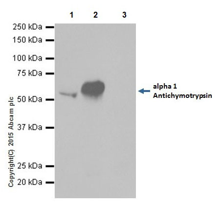 Immunoprecipitation - Anti-AACT antibody [EPR17088-68] (ab205198), expandable thumbnail