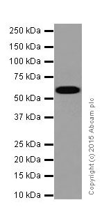 Western blot - Anti-AACT antibody [EPR17088-68] (AB205198), expandable thumbnail