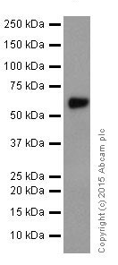 Western blot - Anti-AACT antibody [EPR17088-68] (ab205198), expandable thumbnail