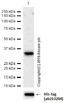 Western blot - Anti-AACT antibody [EPR17088-68] (AB205198), expandable thumbnail