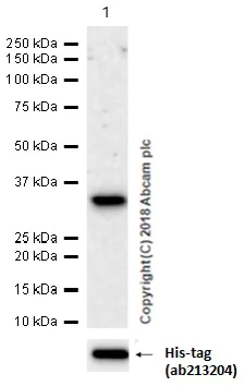 Western blot - Anti-AACT antibody [EPR17088-68] (AB205198)