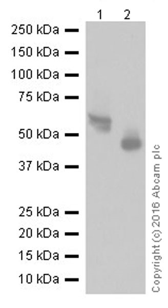 Western blot - Anti-AACT antibody [EPR17088-68] (ab205198), expandable thumbnail