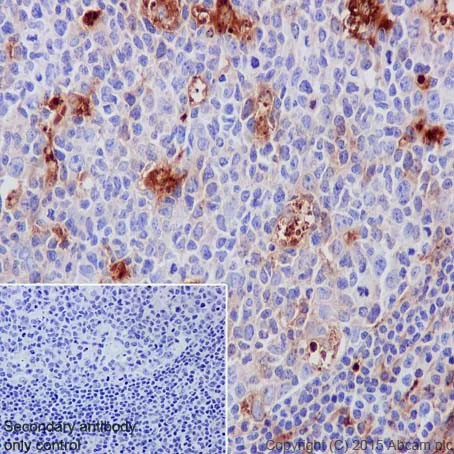 Immunohistochemistry (Formalin/PFA-fixed paraffin-embedded sections) - Anti-AACT antibody [EPR17088-68] - BSA and Azide free (AB223542)