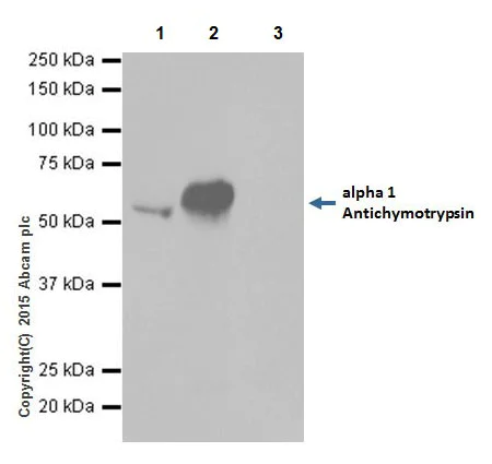 Immunoprecipitation - Anti-AACT antibody [EPR17088-68] - BSA and Azide free (AB223542)