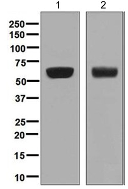 Western blot - Anti-AACT antibody [EPR5905] (AB129194), expandable thumbnail