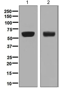 Western blot - Anti-AACT antibody [EPR5905] (AB129194)