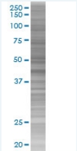 AACT overexpression 293T lysate (whole cell)