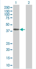 Western blot - AACT overexpression 293T lysate (whole cell) (AB94078)
