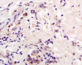 Immunohistochemistry (Formalin/PFA-fixed paraffin-embedded sections) - Anti-AADAC/DAC antibody (AB214184)