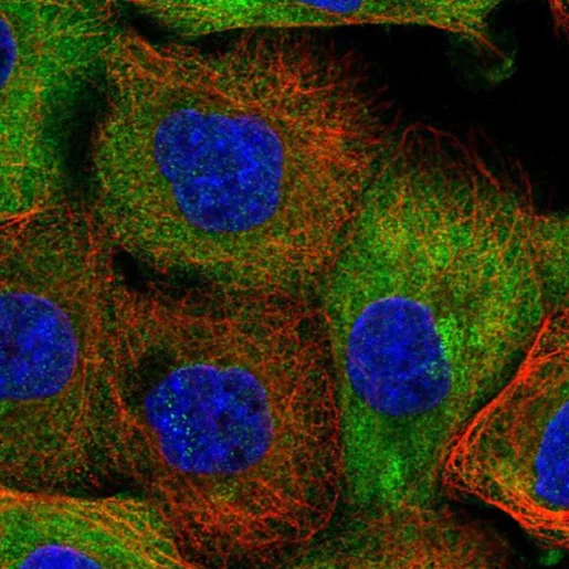 Immunocytochemistry/ Immunofluorescence - Anti-AADACL1 antibody (AB224127)