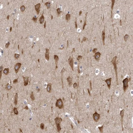 Immunohistochemistry (Formalin/PFA-fixed paraffin-embedded sections) - Anti-AADACL1 antibody (AB224127)