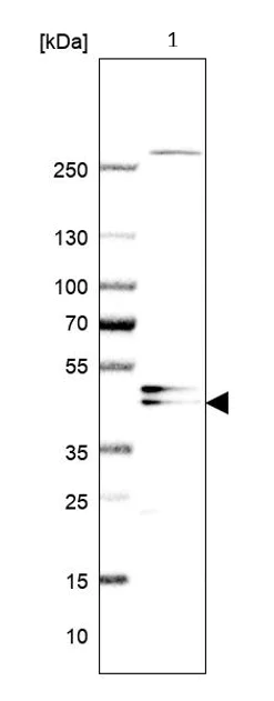 Western blot - Anti-AADACL1 antibody (AB224127)