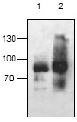 Western blot - Anti-AAK1 antibody (AB59740)